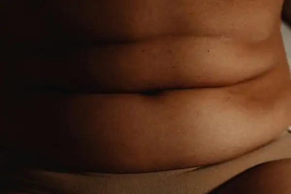 The Hidden Connection: How Stress Shapes Your Fitness and Body Composition 3 image of what stress can do on the stomach area and how Lipo 360 Guildford can help to change your body shape.