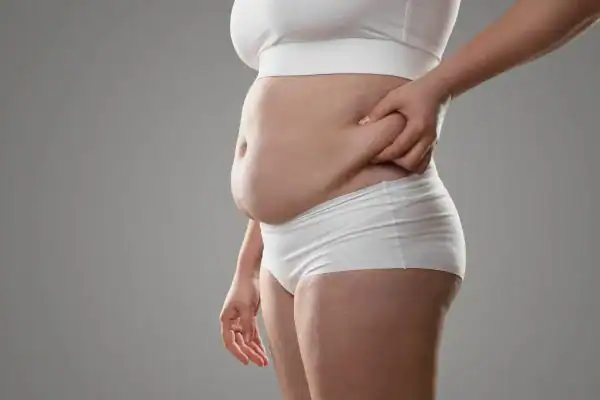 Image of stress belly Guildford How Lipo 360 can help manage your symptoms
